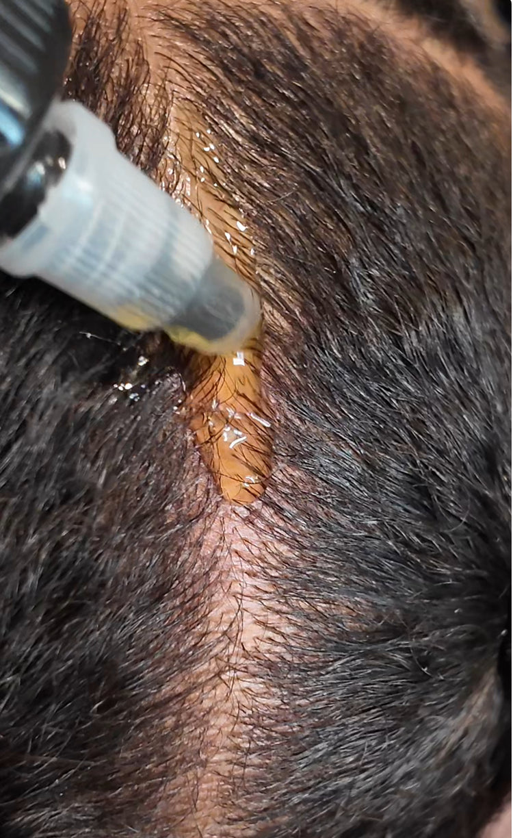 Scalp Care